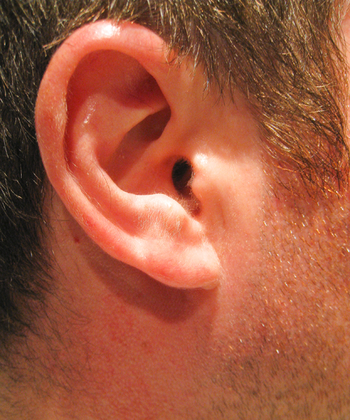 Ear - Right - 104/365