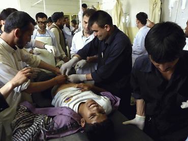 Afghanistan man wounded in violent flare-up in the aftermath of NATO attacks that resulted in the deaths of four civilians in the northern region of the country. US/NATO forces have sparked anger due to the deaths of thousands in bombing raids. by Pan-African News Wire File Photos