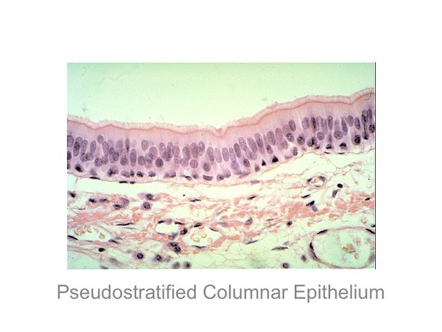 Pseudostratified+columnar+epithelium