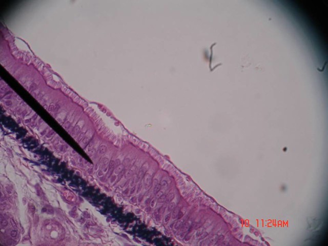 Pseudostratified+columnar