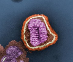 Photo:influenza virus By:kat m research