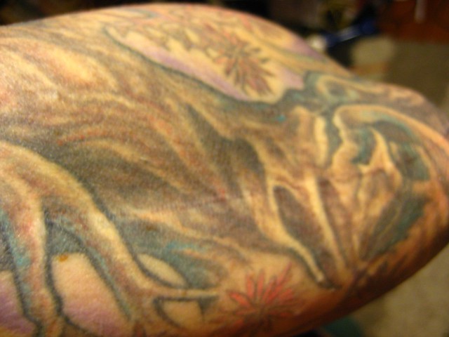 tattoo over scar tissue