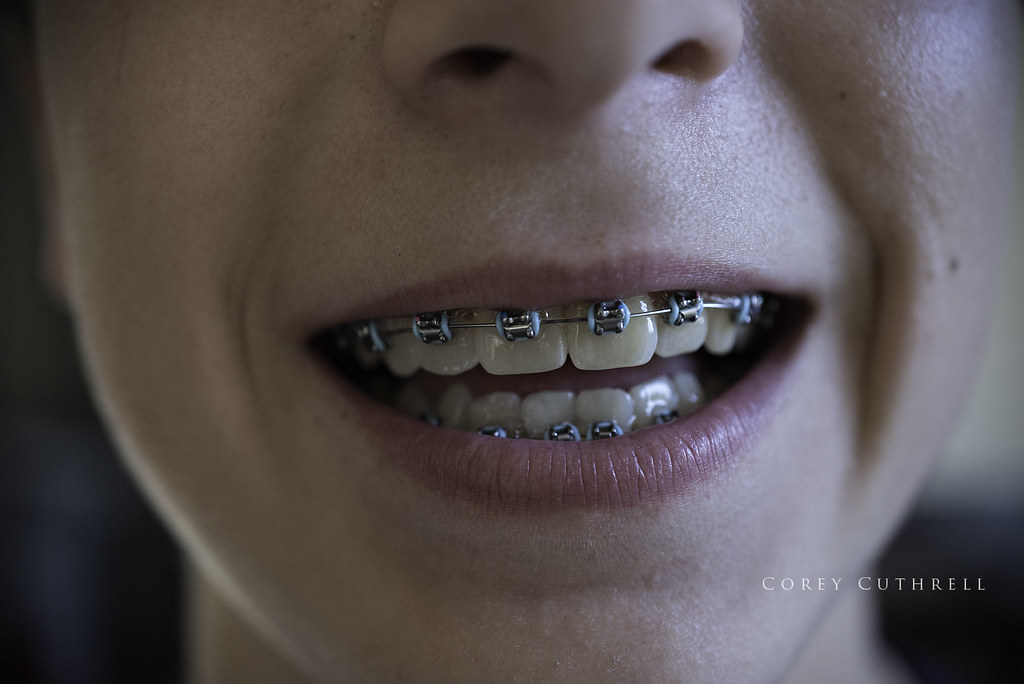 b teeth