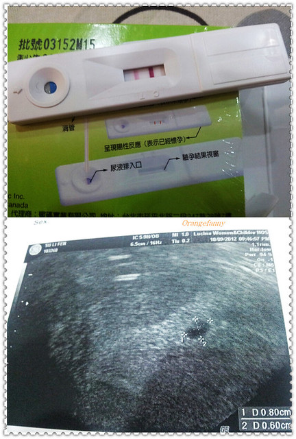 121008.09 懷孕與第一次超音波