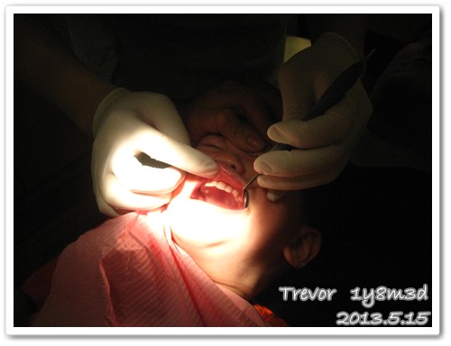 130515-檢查牙齒中