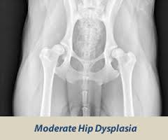 Moderate Hip Dysplasia
