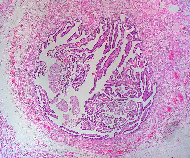 Normal Fallopian Tube, Human | Flickr - Photo Sharing!