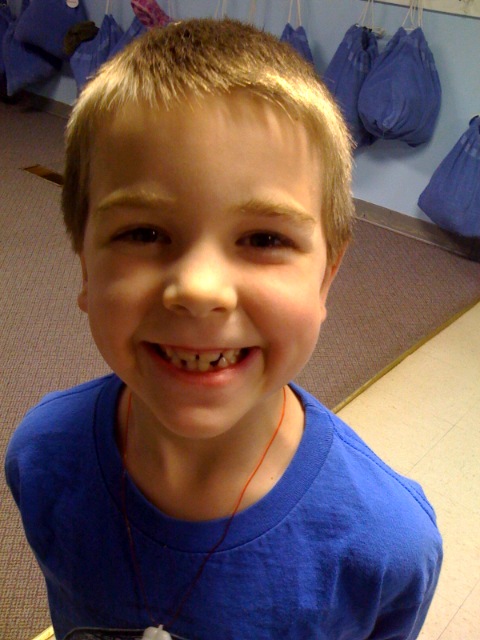 Another tooth gone