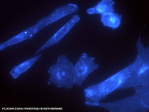 blue stain cell cellular micro microscopic biology cells microscope cho biological microscopy nucleus cholesterol molecular mtsu nuclei vitro phasecontrast filipin chinesehamsterovary chok1 microfirecamera
