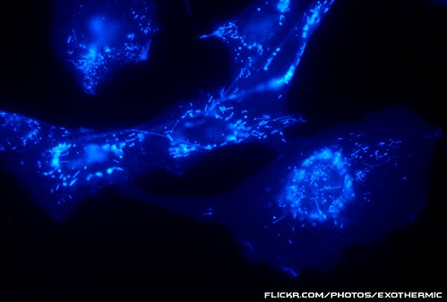 blue stain cell cellular micro microscopic biology cells microscope cho biological microscopy nucleus cholesterol molecular mtsu nuclei vitro phasecontrast filipin chinesehamsterovary chok1 microfirecamera