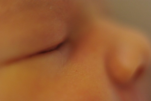 婴儿黄疸分光光度法
