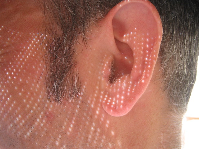 Ear from Flickr via Wylio
