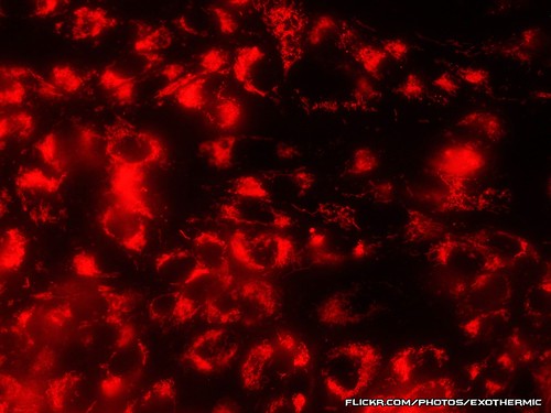 red uv cell cellular micro microscopic biology cells microscope mitochondria cho biological microscopy nucleus molecular mtsu nuclei vitro phasecontrast mitotracker chinesehamsterovary chok1 microfirecamera