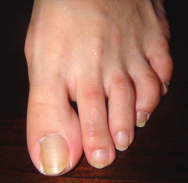 Beautiful Toes | Flickr - Photo Sharing!