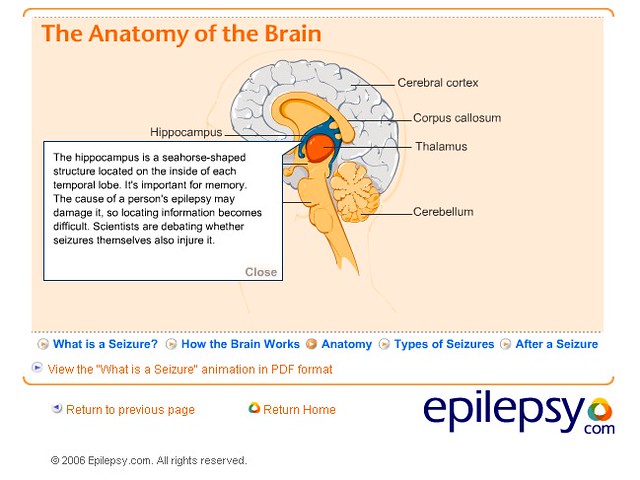 Wireless Brain Implant That Treats Epilepsy Then Melts Away