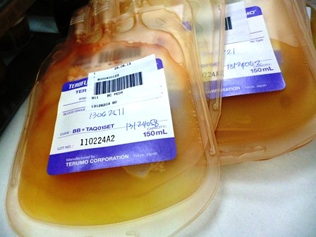 platelet concentrate by Iqbal Osman on Flickr. Used under Creative Commons license. https://flic.kr/p/fEgecv