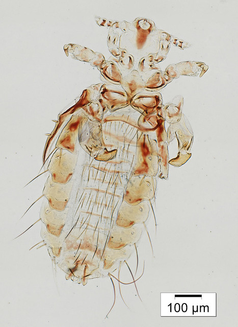 micrograph of male louse, with abdominal projections