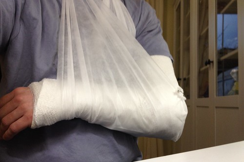Elbow in a cast