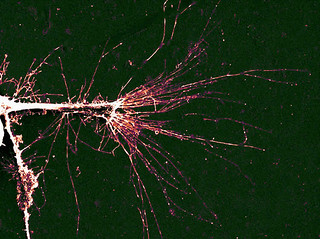 The image shows the PC12 neurons growing on a textured surface.