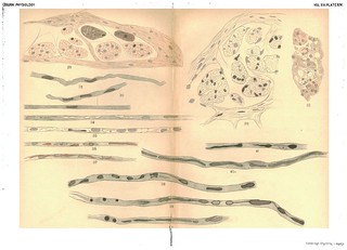 Plate XIV, The Journal of Physiology 13 (5) (1892). Figs 29-41a from W.H. Howell and G.C. Huber, 'A Physiological, Histological and Clinical Study'.