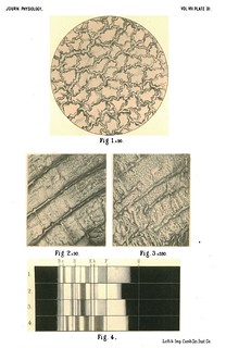 Plate XI, Journal of Physiology 8 (6) (1887). Figs. 1-4 from C.A. MacMunn, 'On the Haematoporphyrin of Solecurtus Strigillatus'.