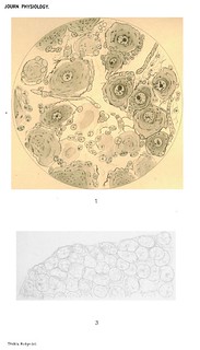 Plate IV, Journal of Physiology 17 (1-2) (1894). Figs. 1-4 from C.F. Hodge, 'Changes in Ganglion Cells from Birth to Senile Death. Observations on Man and Honey-Bee'.
