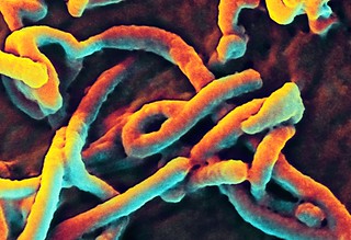 Photo:Ebola Virus By:NIAID