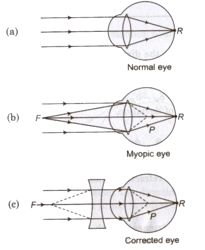 CBSE class 12 Physics Notes Ray Optics