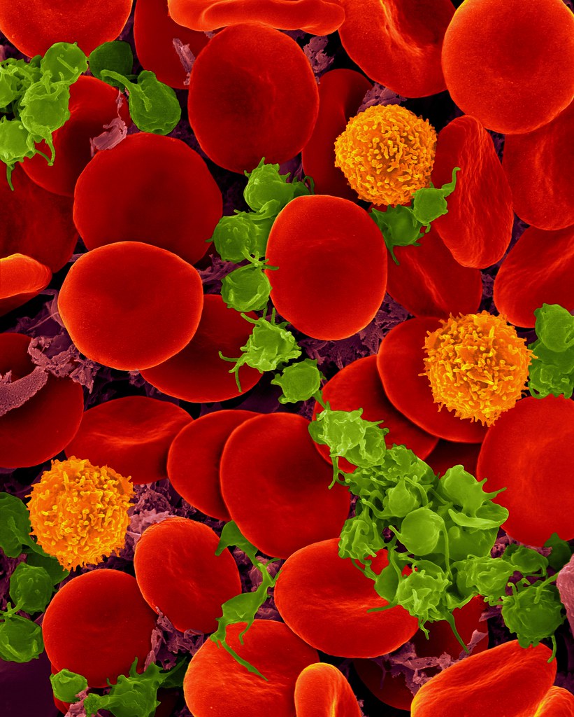 Human blood with red blood cells, T cells (orange) and platelets (green)