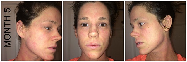 MONTH5 Face
