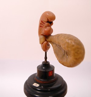 2-3mm Embryo With Yolk Sac