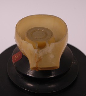 Model 5: Optic Cup, Sectioned Parallel to Opening