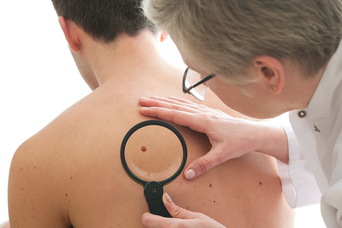 Dr. Joel Schlessinger tells Globe magazine the truth behind myths about skin cancer